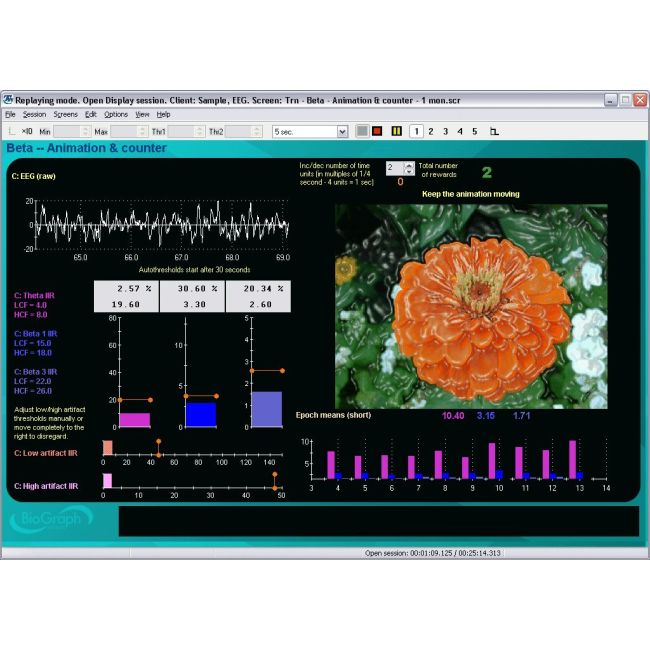 Neurofeedback Expert System
