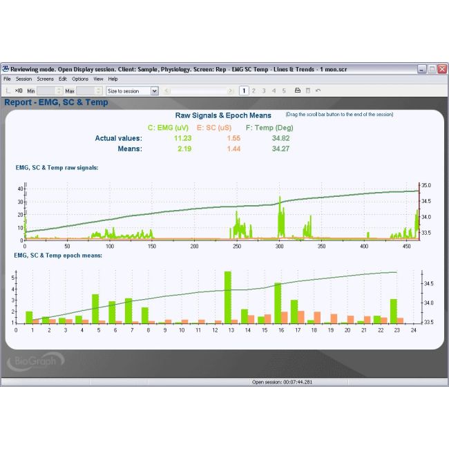 Neurofeedback Expert System