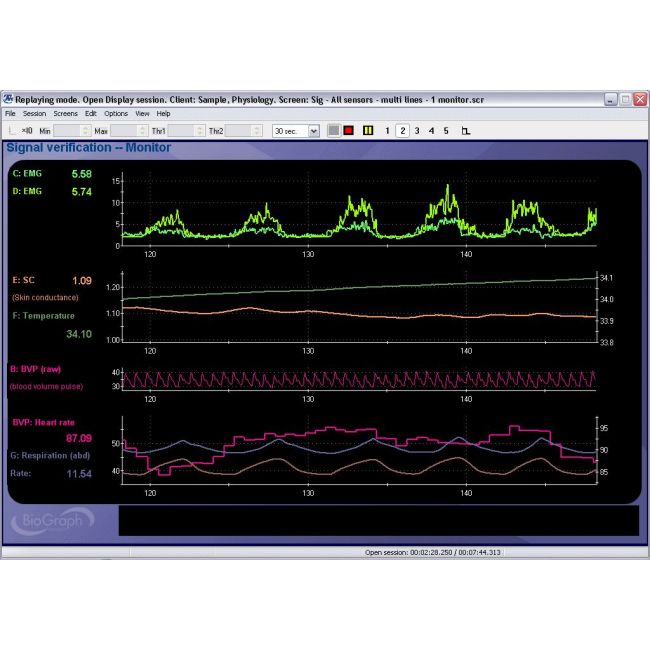 Neurofeedback Expert System