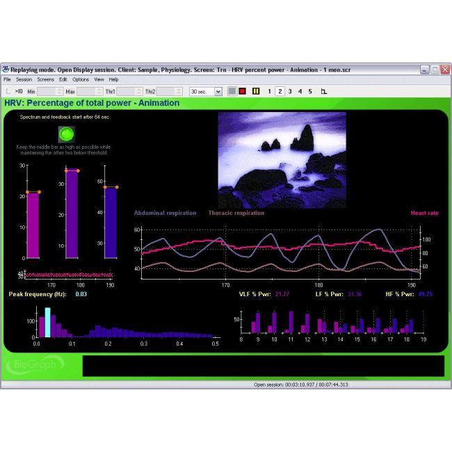 Neurofeedback Expert System